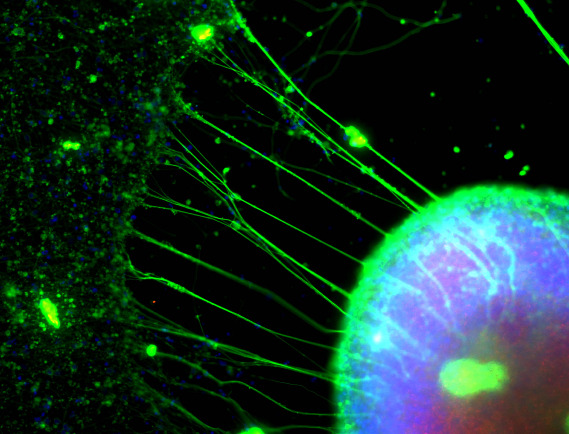PB_D55_neuronsTuj1
