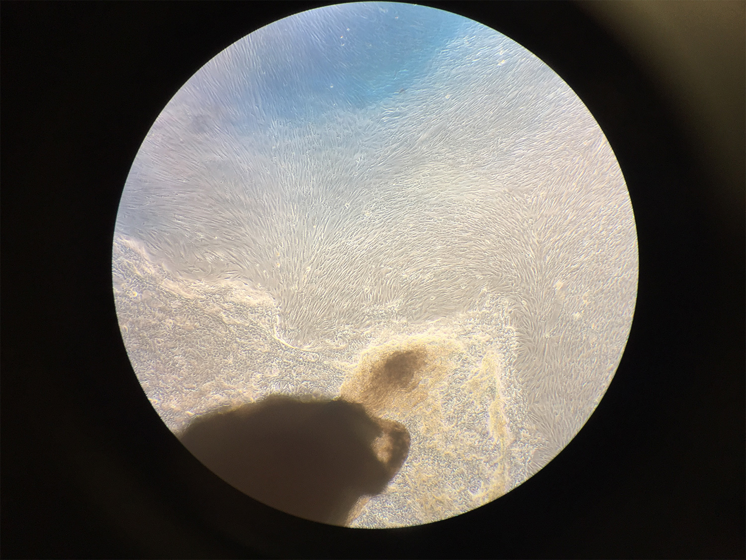 CMurphy_Fibroblasts_2155