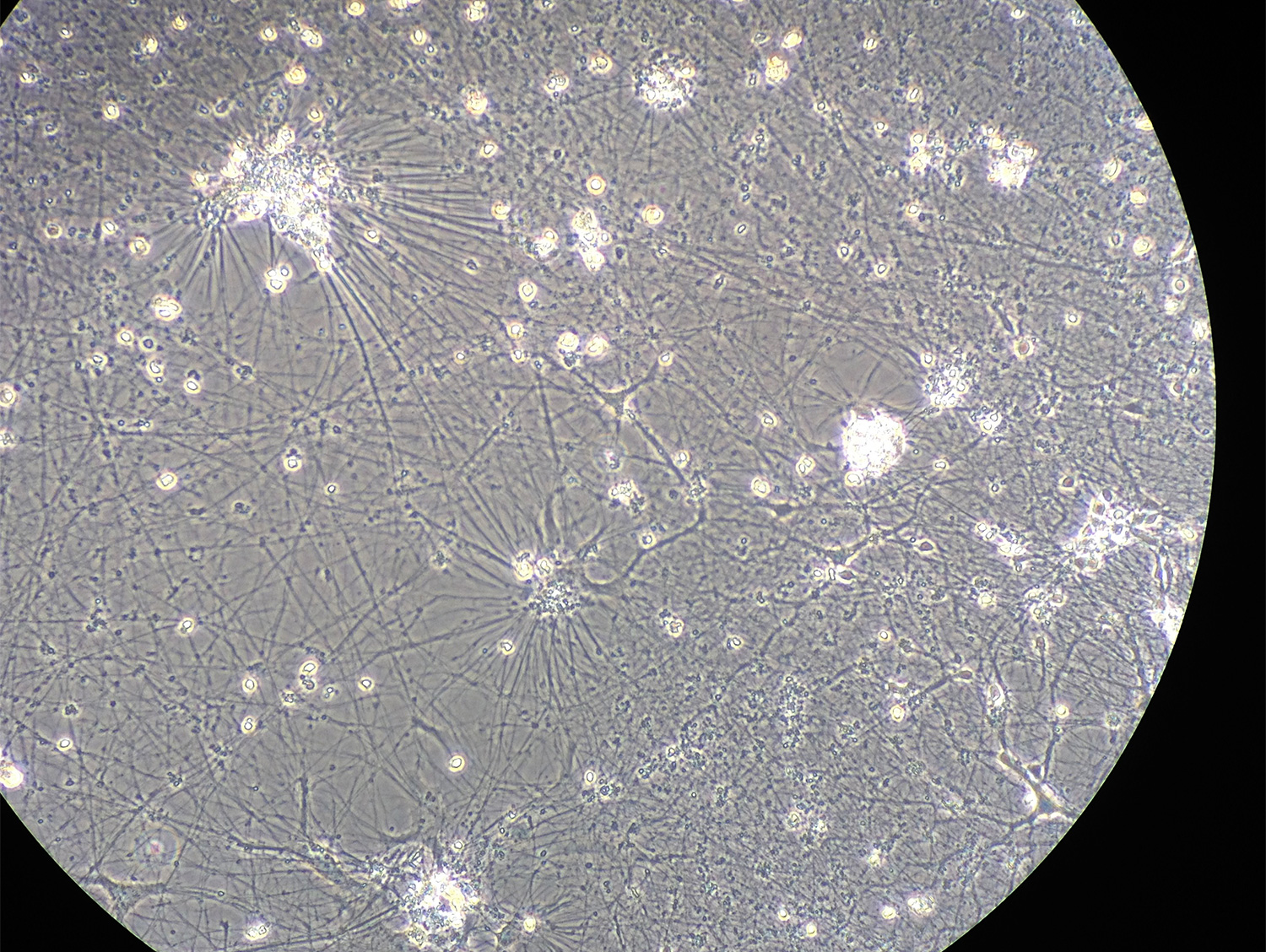 neuronalclusters_2118172064_Selina