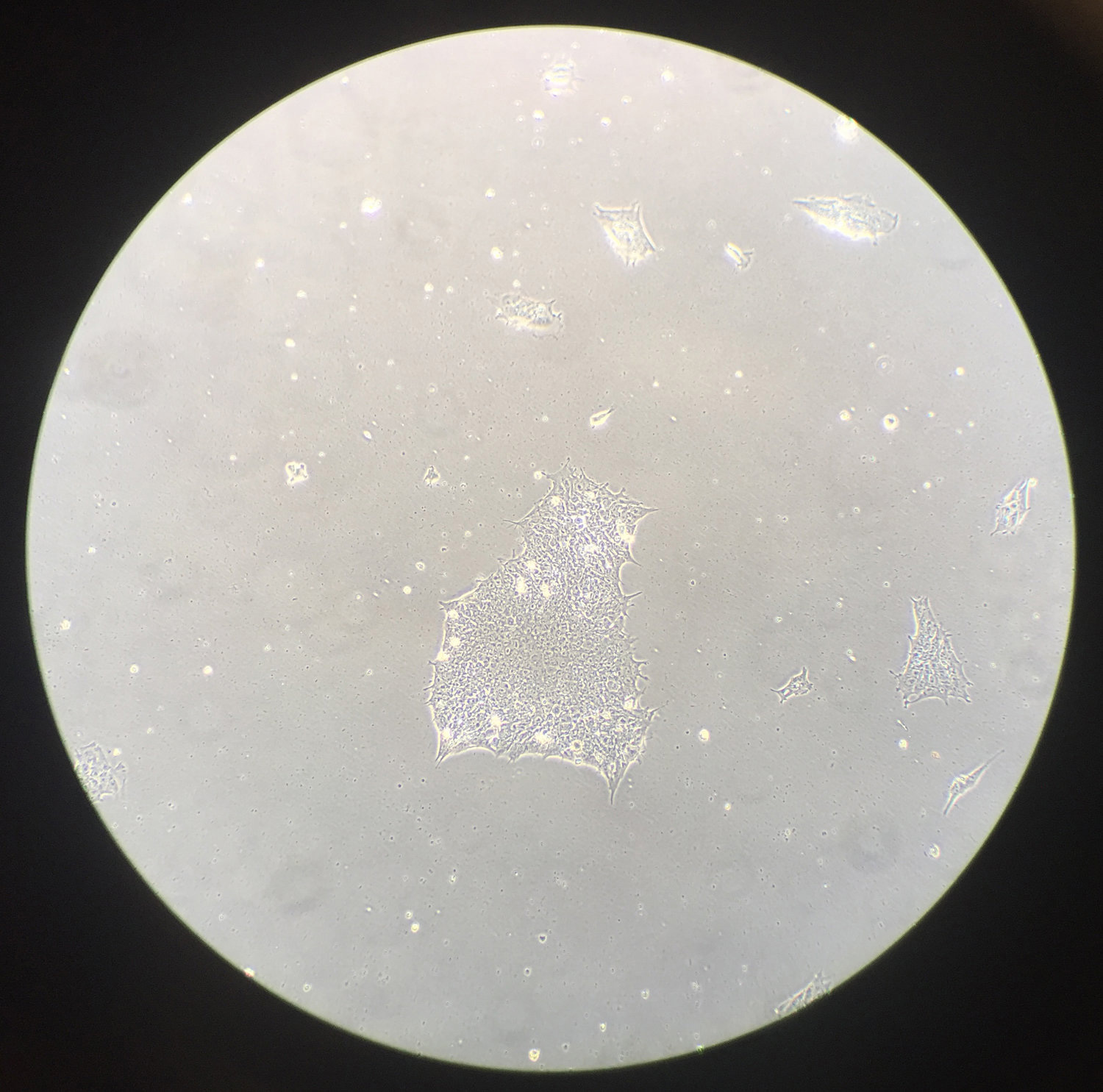 acolonythathasbeentransformedtoastemcelllikestate