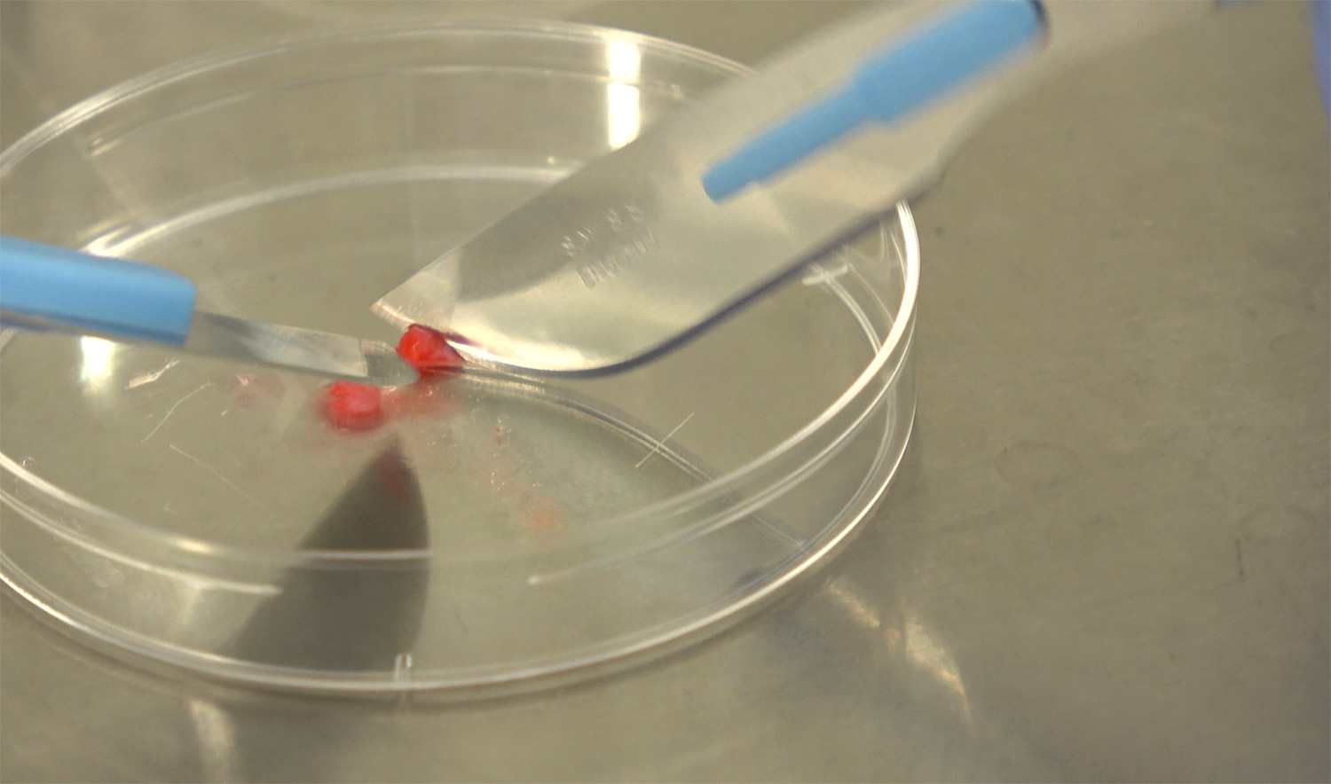cuttingbiopsy