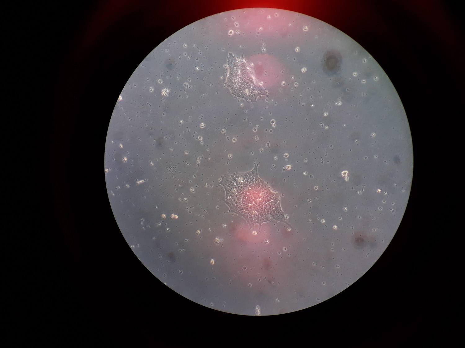 stemcells20180123_172916 copy